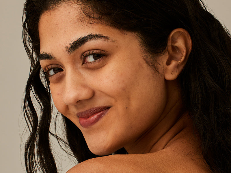 How to treat congested and breakout-prone skin