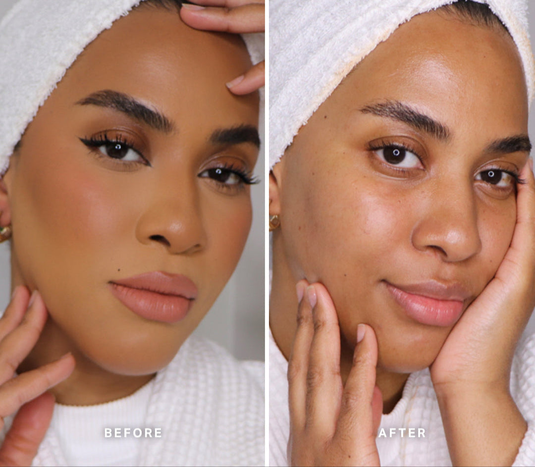 Before-And-After-Trial-MMCB_SABAH_0c1c5ac6-1a36-489a-bc3a-5d00da7f807f.jpg