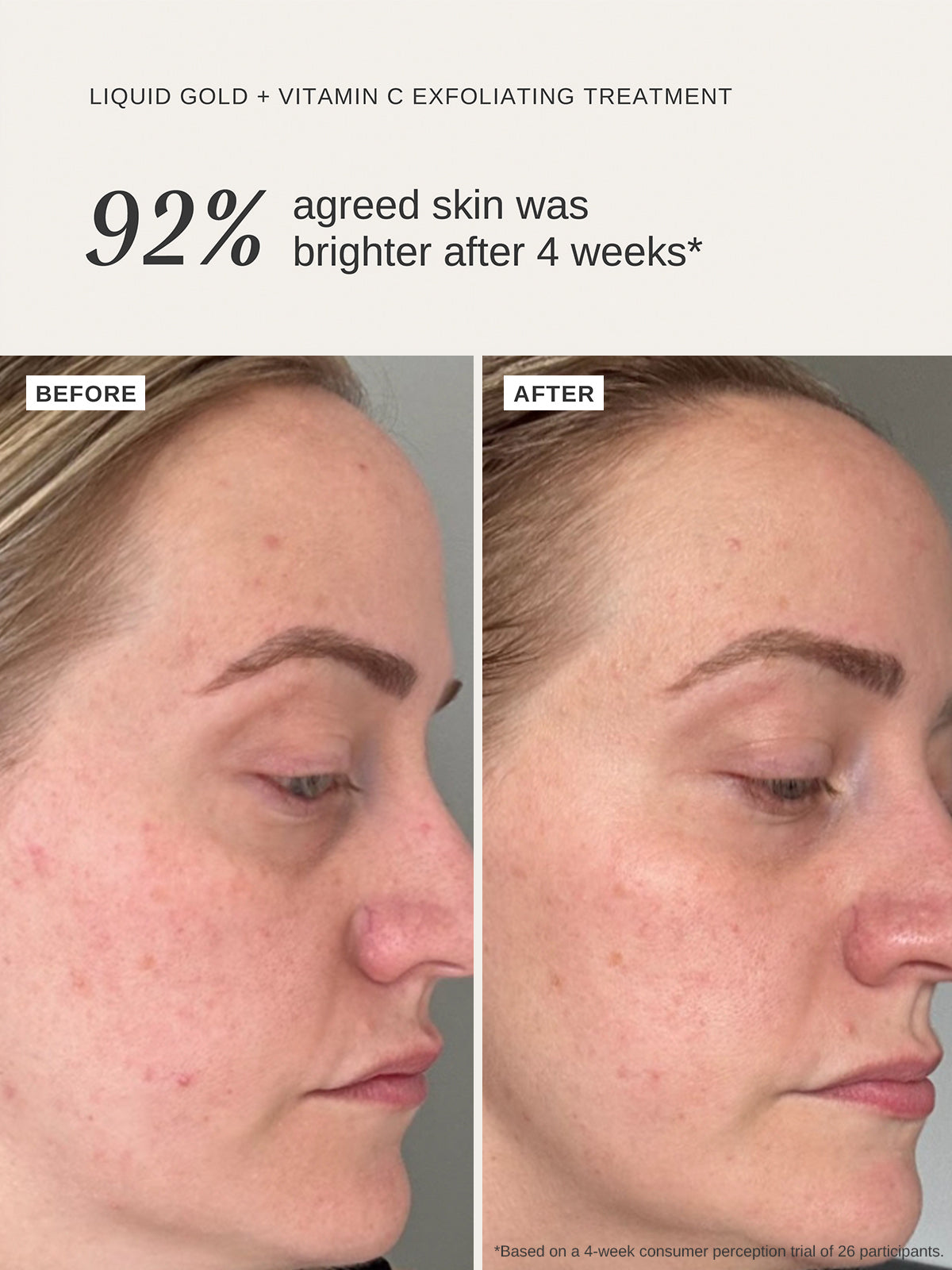 Radiance Repair Duo