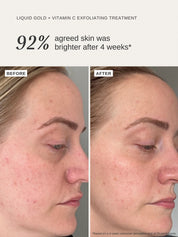 Liquid Gold + Vitamin C Trial Kit